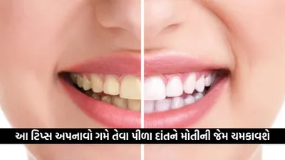 પીળા દાંતને કારણે તમે શરમ અનુભવો છો  તો અપનાવો આ ટિપ્સ  માત્ર 15 જ દિવસમાં દાંતને મોતીની જેમ ચમકાવશે    