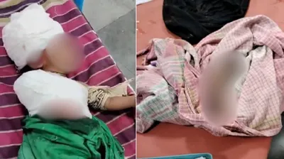 સુરત પાલિકાની આવાસ સાઇટ પર બાળકનો હાથ લિફ્ટમાં આવી જતાં કપાયો  સિવિલમાં 1 વર્ષના બાળકના જીવન મરણ વચ્ચે ઝોલાં