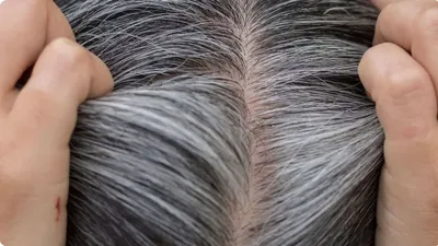 લીંબુના રસમાં આ સીક્રેટ વસ્તુ નાંખીને વાળમાં લગાવો  મહેંદી કે ડાઇ વિના નેચરલી કાળા થશે સફેદ વાળ